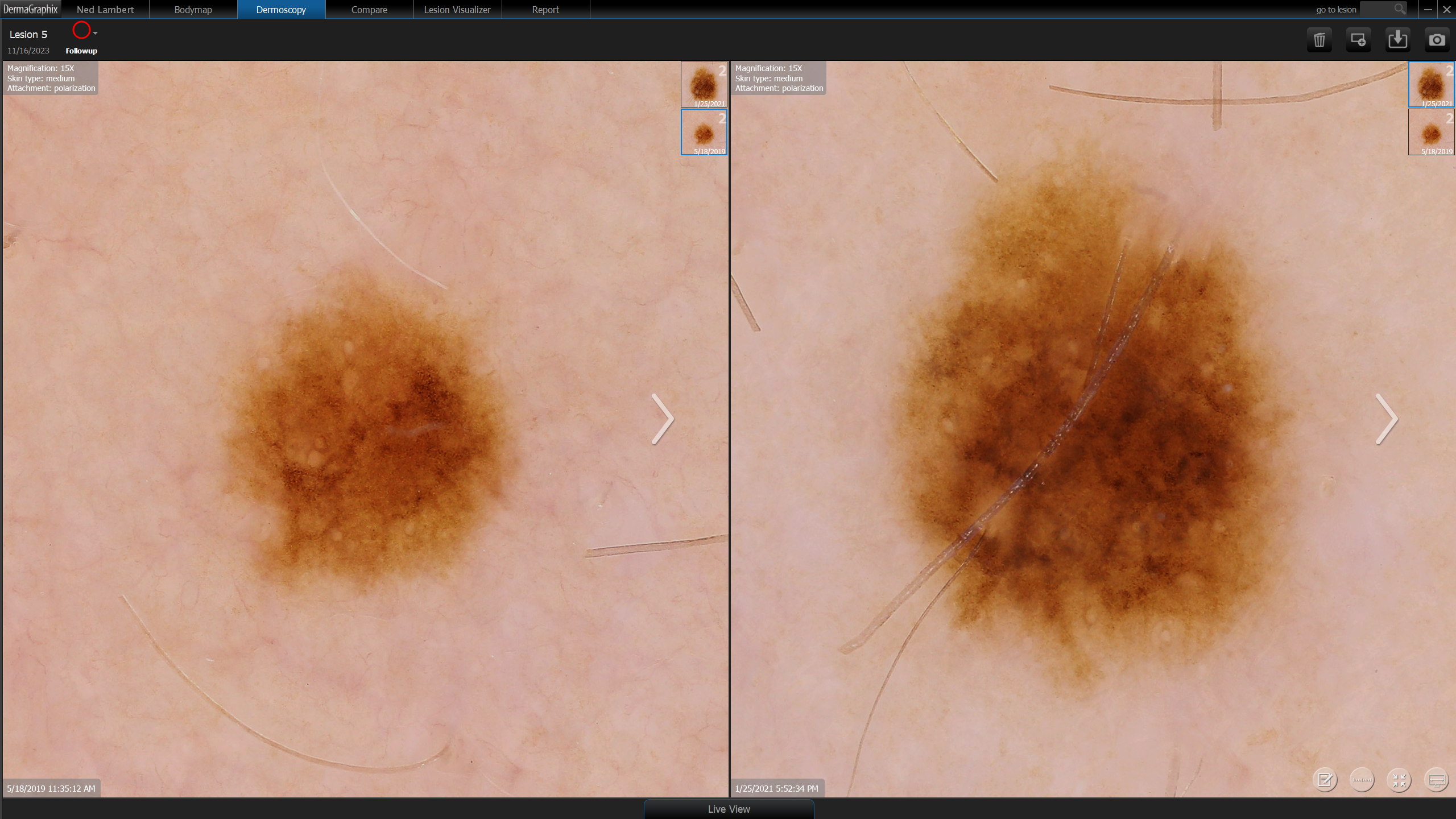 Longitudinal Skin Monitoring